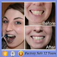 Professionelle Magic Mud Whitening Zahnpulver HomeTeeth Whitening